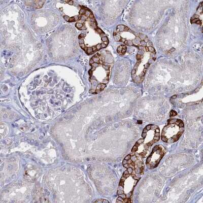 Immunohistochemistry: FAM159A Antibody [NBP2-48597]