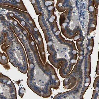 Immunohistochemistry: FAM159B Antibody [NBP1-91103]