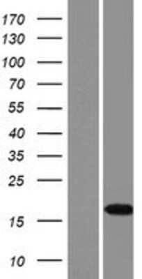 Western Blot: FAM159B Overexpression Lysate [NBP2-10139]