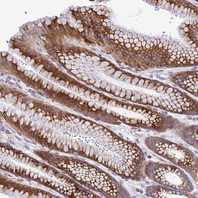 Immunohistochemistry-Paraffin: FAM160A1 Antibody [NBP1-93760]