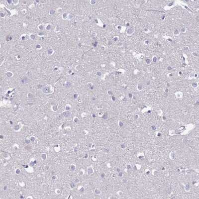 Immunohistochemistry-Paraffin: FAM160A1 Antibody [NBP1-93760]