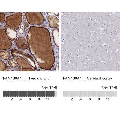 Immunohistochemistry-Paraffin: FAM160A1 Antibody [NBP1-93760]