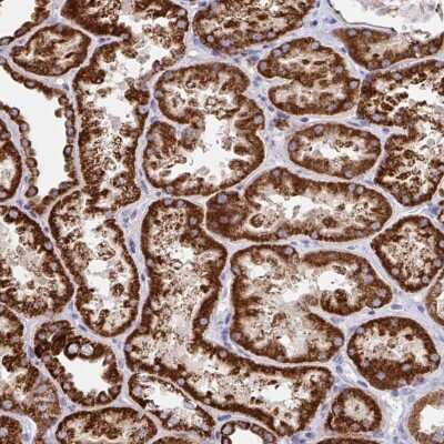 Immunohistochemistry-Paraffin: FAM160A2 Antibody [NBP2-34173]