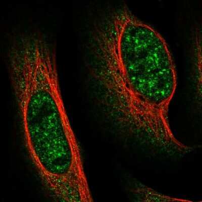 Immunocytochemistry/ Immunofluorescence: FAM160B1 Antibody [NBP1-88970]