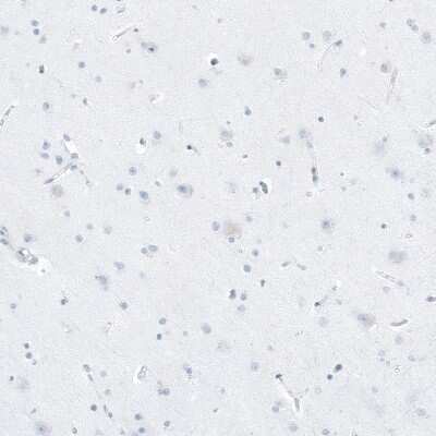 Immunohistochemistry-Paraffin: FAM161A Antibody [NBP1-94022]