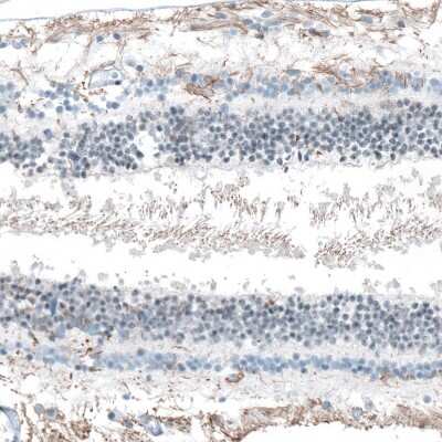Immunohistochemistry-Paraffin: FAM161A Antibody [NBP1-94022]