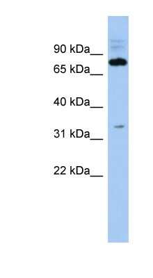 Western Blot: FAM161B Antibody [NBP1-56722]