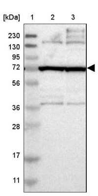 Western Blot: FAM161B Antibody [NBP1-88421]