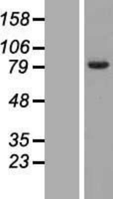 Western Blot: FAM161B Overexpression Lysate [NBL1-10488]