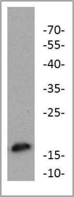 Western Blot: FAM162A Antibody [NBP2-58663]