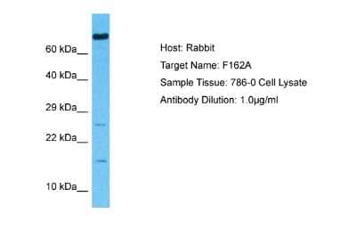 Western Blot: FAM162A Antibody [NBP2-84893]