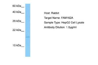 Western Blot: FAM162A Antibody [NBP2-84894]