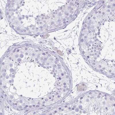 Immunohistochemistry-Paraffin: FAM162B Antibody [NBP2-32533]