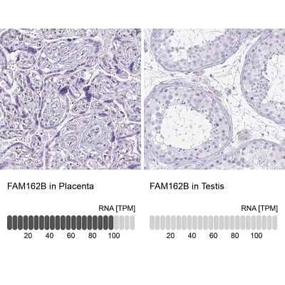 Immunohistochemistry-Paraffin: FAM162B Antibody [NBP2-32533]