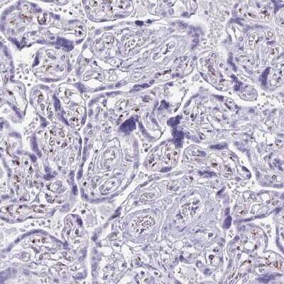 Immunohistochemistry-Paraffin: FAM162B Antibody [NBP2-32533]