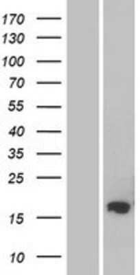 Western Blot: FAM162B Overexpression Lysate [NBP2-08438]