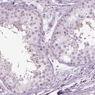 Immunohistochemistry-Paraffin: FAM164C Antibody [NBP2-62647]