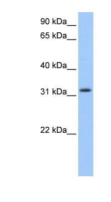 Western Blot: FAM164C Antibody [NBP1-57701]