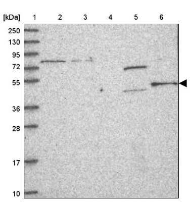 Western Blot: FAM164C Antibody [NBP2-47462]