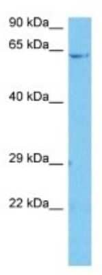 Western Blot: FAM164C Antibody [NBP3-10859]