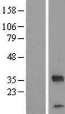 Western Blot: FAM164C Overexpression Lysate [NBL1-10492]