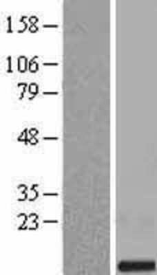 Western Blot: FAM165B Overexpression Lysate [NBL1-10493]