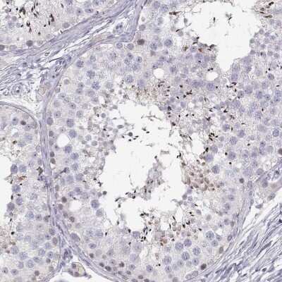 Immunohistochemistry-Paraffin: FAM166A Antibody [NBP1-90930]