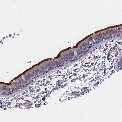 Immunohistochemistry-Paraffin: FAM166B Antibody [NBP1-94176]