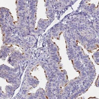 Immunohistochemistry-Paraffin: FAM166B Antibody [NBP1-94176]