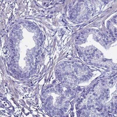 Immunohistochemistry-Paraffin: FAM166B Antibody [NBP1-94176]