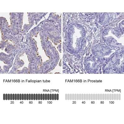 Immunohistochemistry-Paraffin: FAM166B Antibody [NBP1-94176]