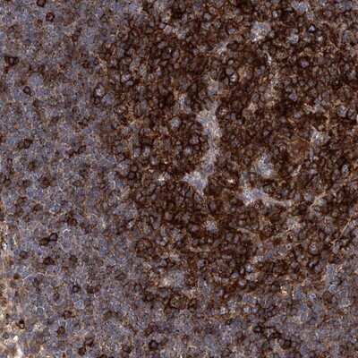 Immunohistochemistry-Paraffin: FAM167A Antibody [NBP1-91236]