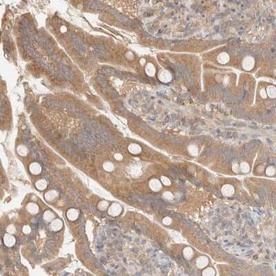 Immunohistochemistry-Paraffin: FAM167A Antibody [NBP1-91237]