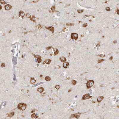 Immunohistochemistry-Paraffin: FAM167B Antibody [NBP1-88321]