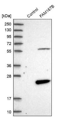 Western Blot: FAM167B Antibody [NBP1-88321]