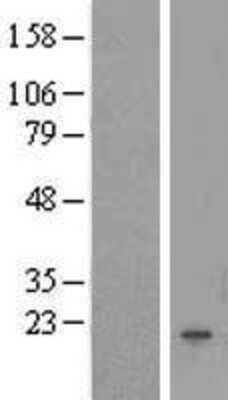 Western Blot: FAM167B Overexpression Lysate [NBL1-10494]