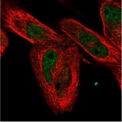 Immunocytochemistry/ Immunofluorescence: FAM168A Antibody [NBP1-81525]