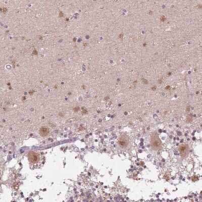Immunohistochemistry-Paraffin: FAM168A Antibody [NBP1-81525]