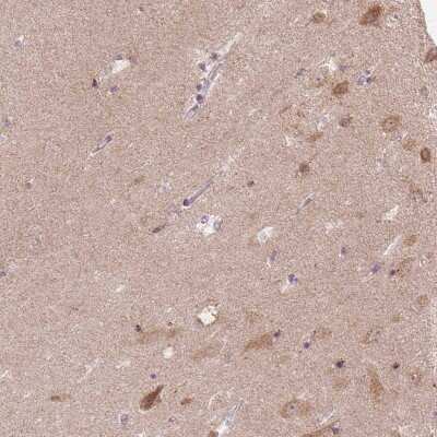 Immunohistochemistry-Paraffin: FAM168A Antibody [NBP1-81525]
