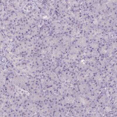 Immunohistochemistry-Paraffin: FAM168A Antibody [NBP1-81525]
