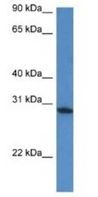 Western Blot: FAM168A Antibody [NBP1-74067]