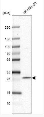 Western Blot: FAM168A Antibody [NBP1-81525]