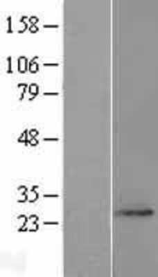 Western Blot: FAM168A Overexpression Lysate [NBL1-10495]