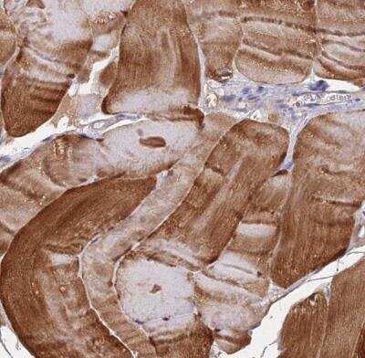 Immunohistochemistry-Paraffin: FAM168B Antibody [NBP1-93650]