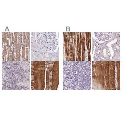 Immunohistochemistry-Paraffin: FAM168B Antibody [NBP1-93650]