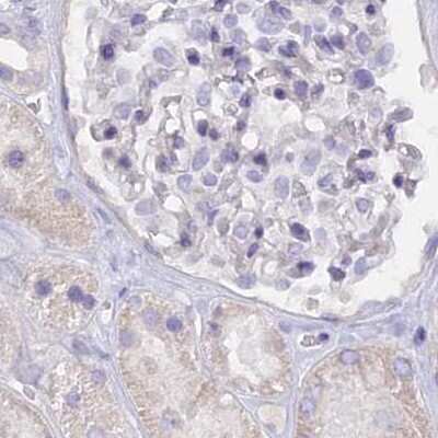 Immunohistochemistry-Paraffin: FAM168B Antibody [NBP1-93650]