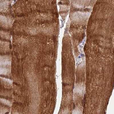 Immunohistochemistry-Paraffin: FAM168B Antibody [NBP1-93650]