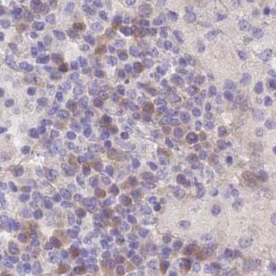 Immunohistochemistry-Paraffin: FAM168B Antibody [NBP1-93650]