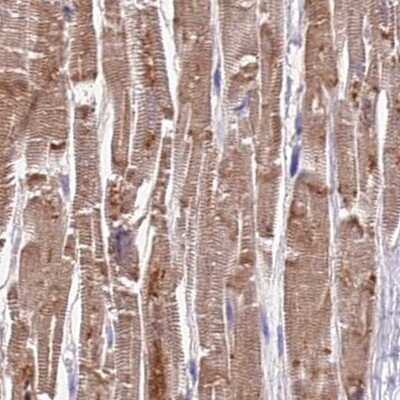 Immunohistochemistry-Paraffin: FAM168B Antibody [NBP1-93650]