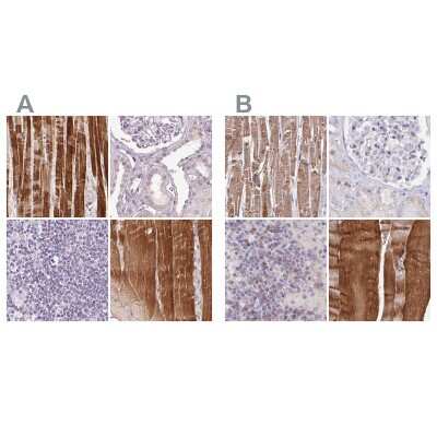 Immunohistochemistry-Paraffin: FAM168B Antibody [NBP2-49343]